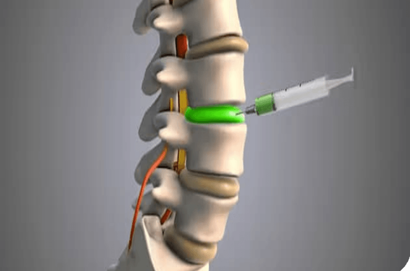 دیسکوژل کمر و گردن