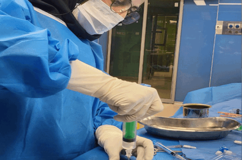 کاشت پمپ درد نخاعی